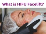 What is HIFU Facelift?